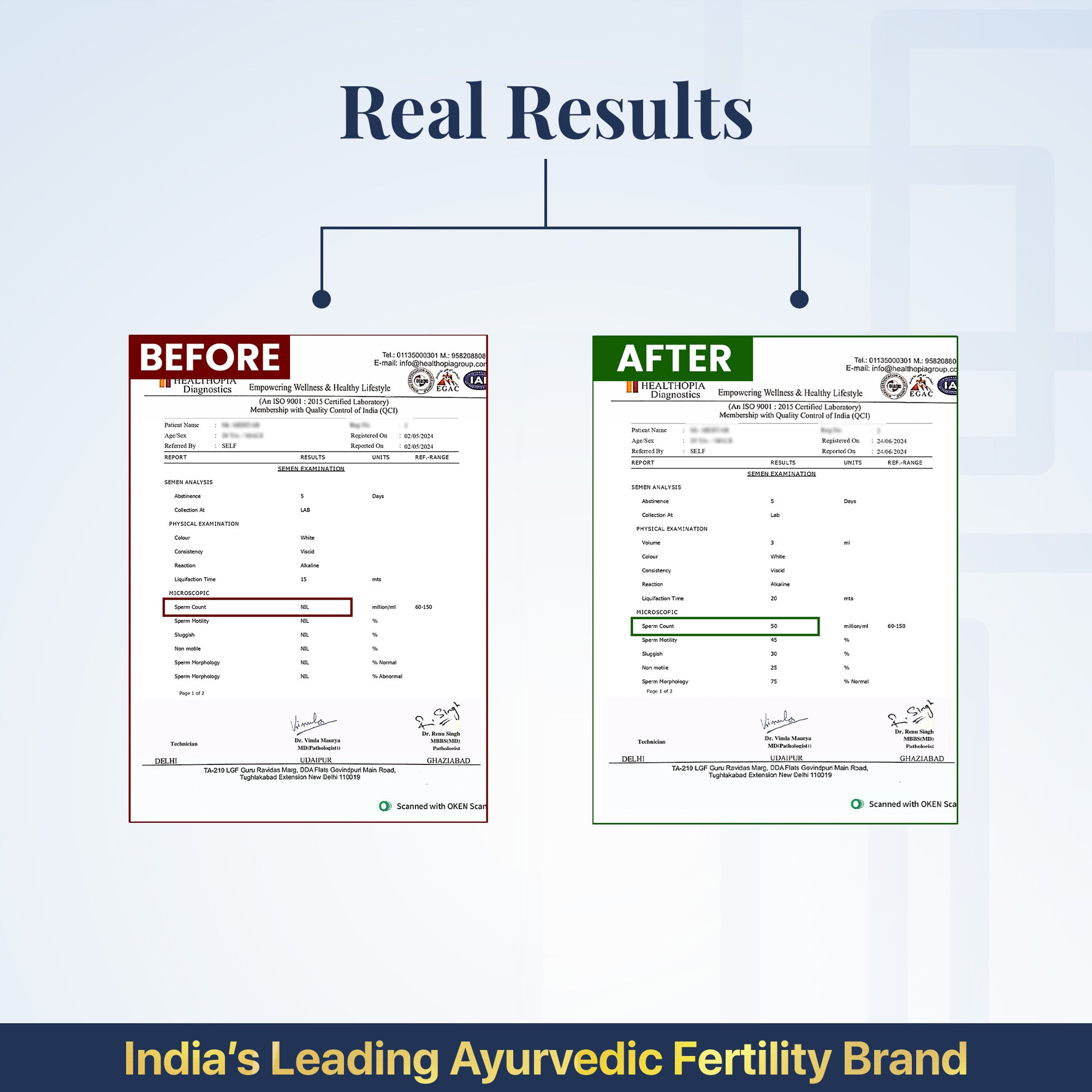 विटालक्स (पुरुषों की प्रजनन क्षमता बढ़ाने वाली गोलियाँ)